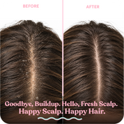 Scalp Brush